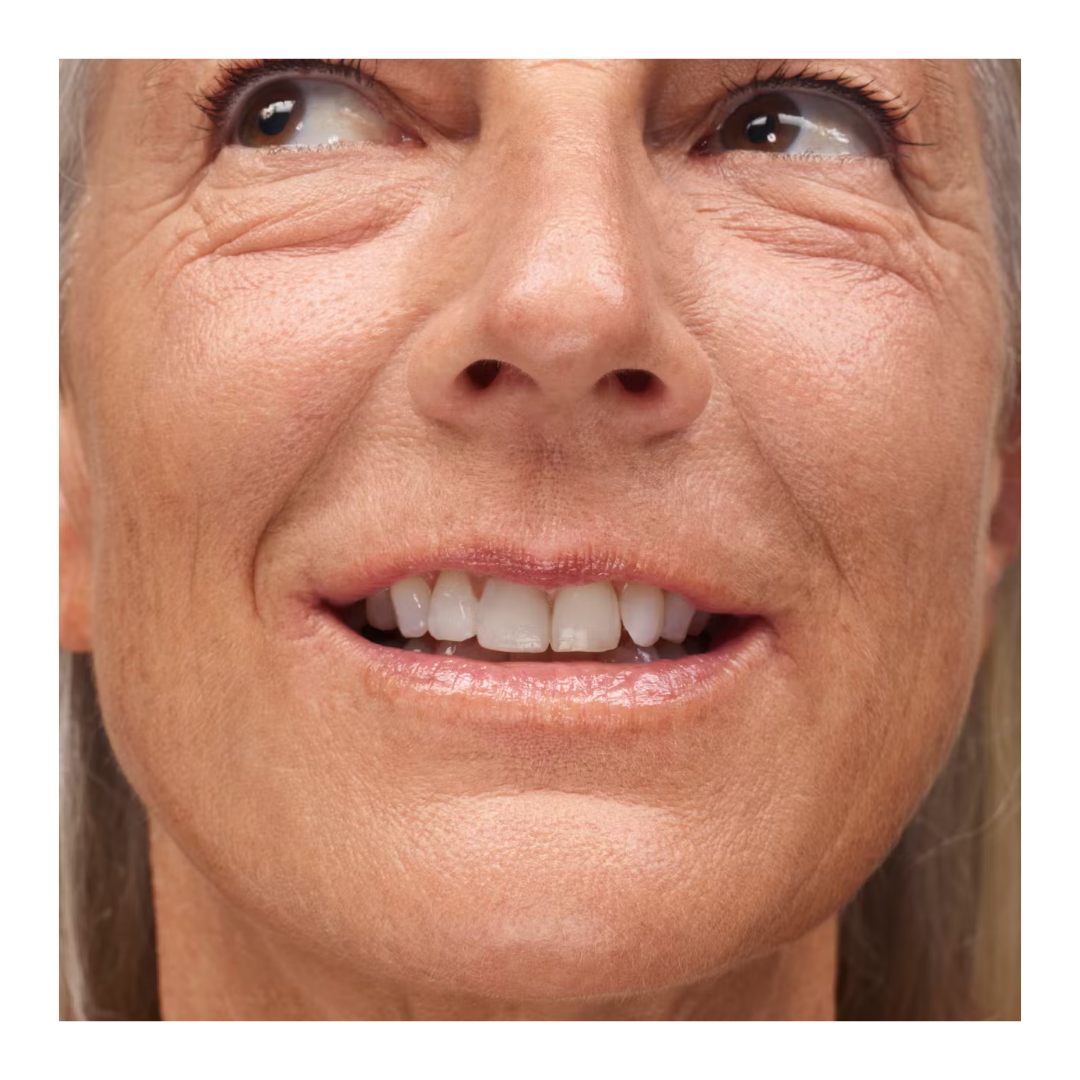 Balsamo para labios GLOSSIER Dotcolm 15ml