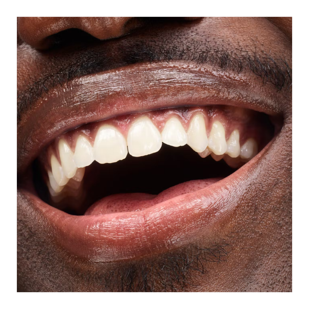 Balsamo para labios GLOSSIER Dotcolm 15ml