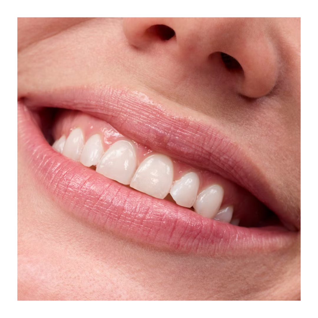 Balsamo para labios GLOSSIER Dotcolm 15ml